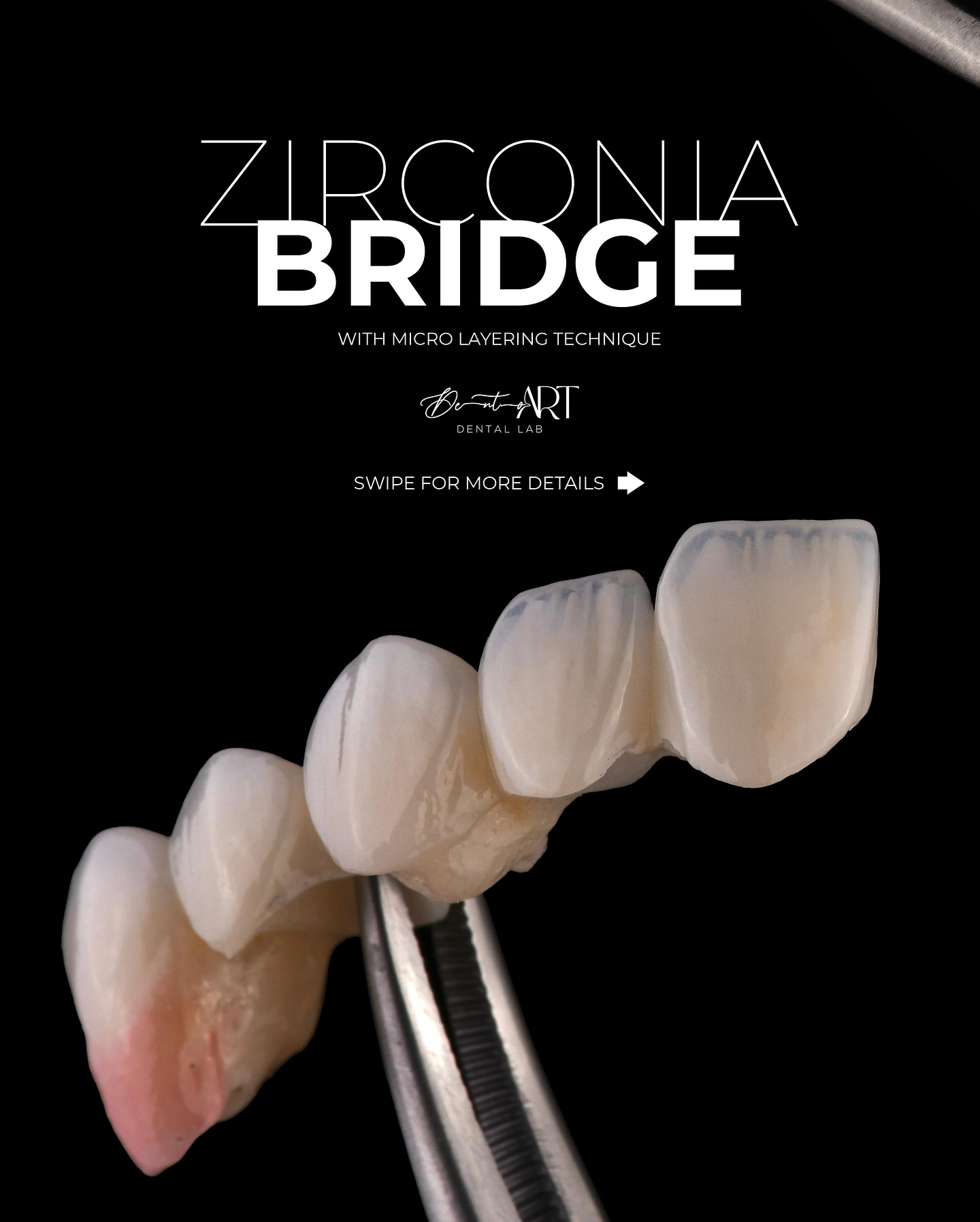 Zirconia Restorations crafted by Dento Art